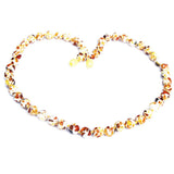 Baltic Amber Dalmatian Pattern Necklace